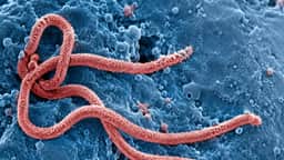 França confirma primeiro caso de ebola em médico vindo do Congo
