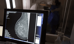 Mamografias em BH crescem 164% em 2026