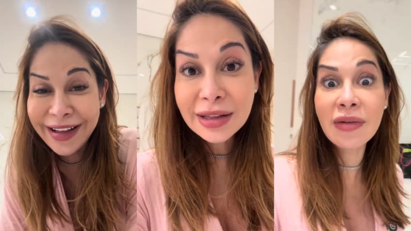 Maíra Cardi exibe rosto deformado após botox dar errado