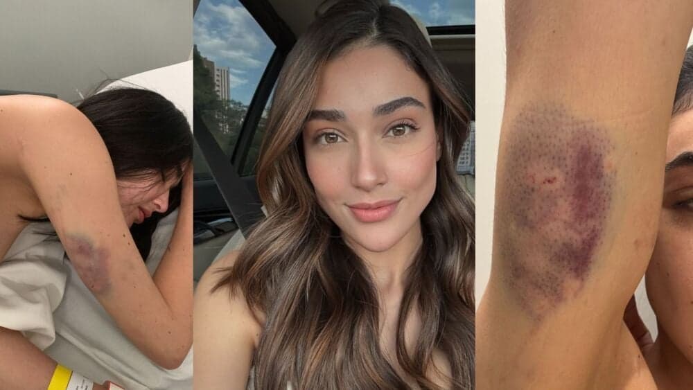 Empresária obtém medida protetiva após agressões sofridas em Nova Lima