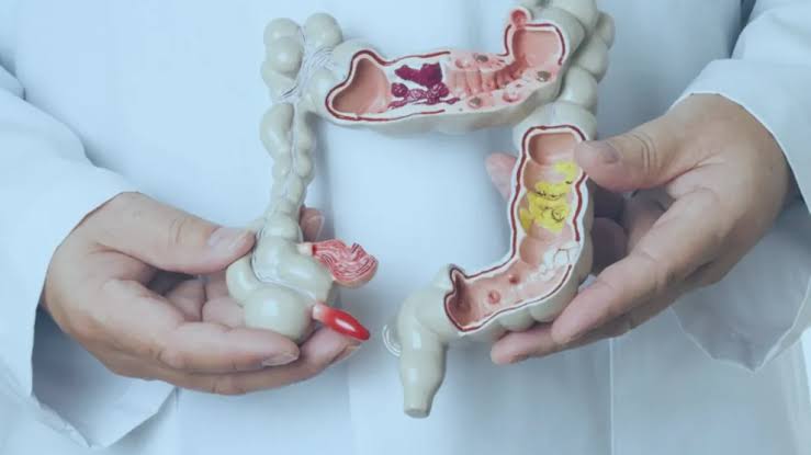 Câncer avança em Minas e pode se tornar principal causa de morte no país, aponta Inca