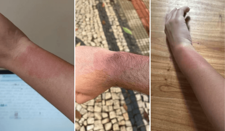 Fãs relatam queimaduras após uso de pulseiras de LED em show de Luan Santana em BH